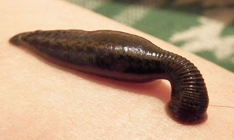 मनीषा कोईराला आणि जळवा / जळू  Leeches